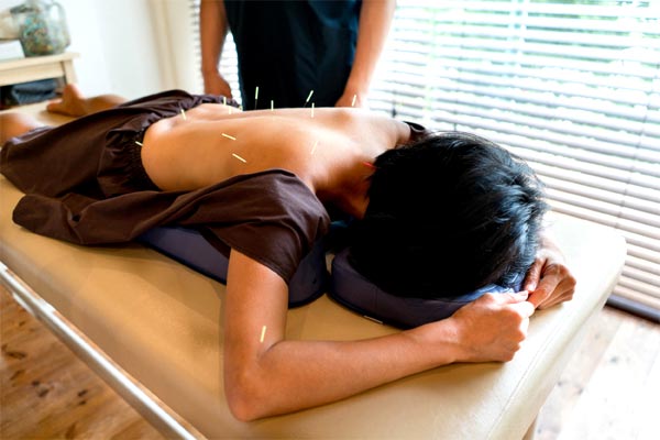 Best Acupuncture Perth - Tao Acupuncture