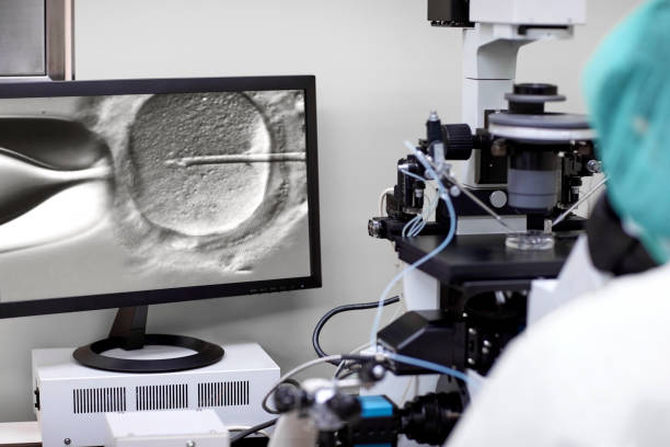 acupuncture in IVF treatment