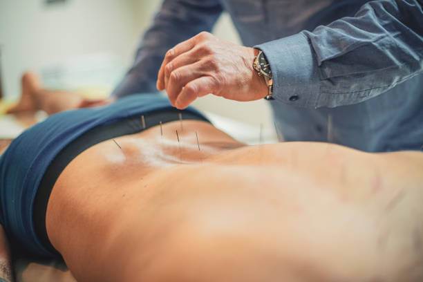 Acupuncture in Traditional Chinese Medicine