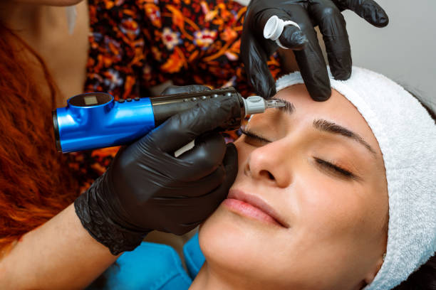Cosmetic Acupuncture